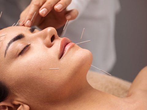 Acupuncture: Questions and Answers with an Expert