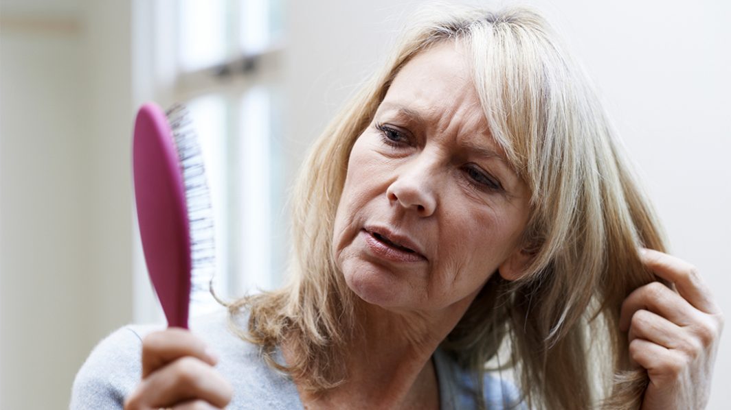 Menopause and Hair Loss