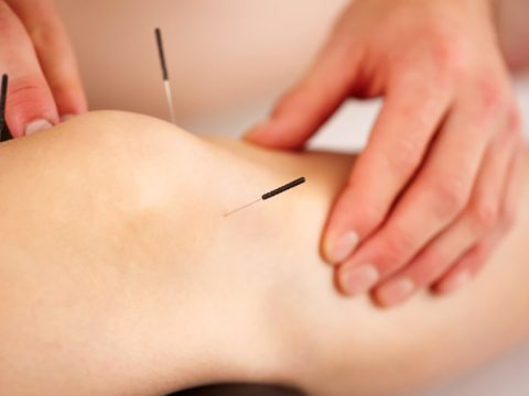 Suffering from Osteoarthritis? Acupuncture to the Rescue