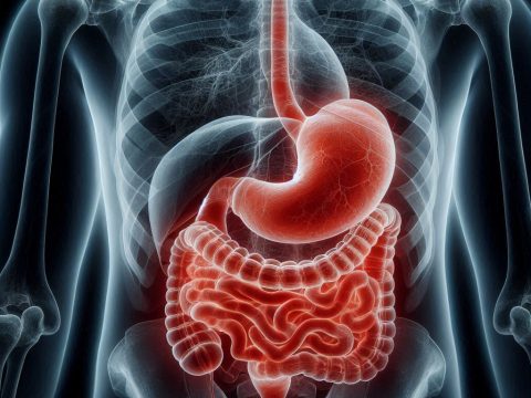 Gastric Bypass Complication Rates Need To Be Viewed In The Longer Term