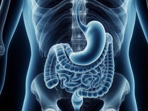 Vertical Gastrectomy Shows Promising Results For The Super Obese