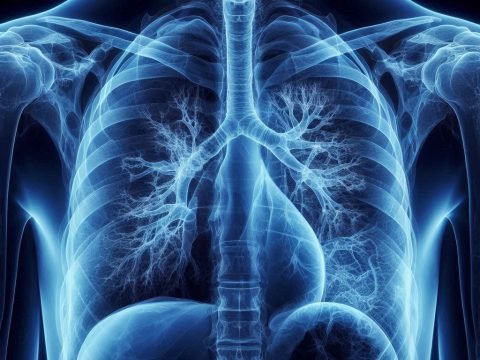 Understanding Cystic Fibrosis Causes, Symptoms, and Treatment Options