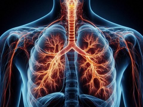 Bronchiectasis Causes Symptoms Information with Treatment