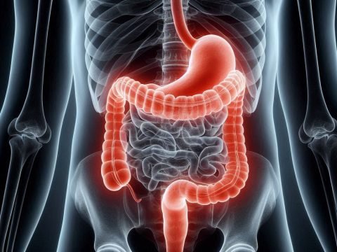 Gastroparesis - Causes, Symptoms and Treatment Methods