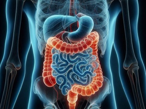 Probiotics Can Help to Treat Crohn’s Disease